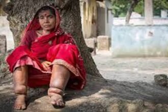 Saharsa Filariasis Campaign 2026